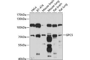 Western blot analysis of extracts of various cell lines, using GPC5 antibody (ABIN6127989, ABIN6141313, ABIN6141314 and ABIN6214656) at 1:1000 dilution. (GPC5 抗体  (AA 320-550))