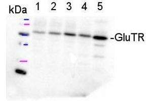 Western Blotting (WB) image for anti-Solute Carrier Family 1 (Glial High Affinity Glutamate Transporter), Member 2 (SLC1A2) antibody (ABIN619538)