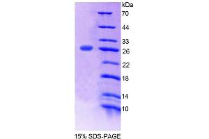 SDS-PAGE analysis of Mouse POMT1 Protein. (POMT1 蛋白)