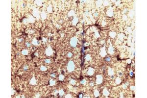 Glutamine synthetase staining on a rat cerebrum section. (GLN1 抗体  (AA 1-373))