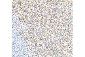 Immunohistochemistry (IHC) image for anti-CD16 (CD16) (AA 21-201) antibody (ABIN7449423)