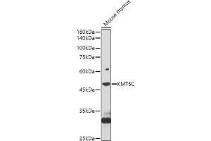 Western blot analysis of extracts of Mouse thymus, using KMT5C antibody (ABIN7270649) at 1:1000 dilution. (SUV420H2/KMT5C 抗体  (AA 100-200))