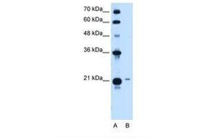 Image no. 2 for anti-T-Complex 10 (TCP10) (AA 109-158) antibody (ABIN321002) (TCP10 抗体  (AA 109-158))
