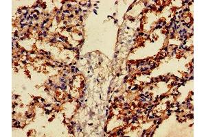 Immunohistochemistry of paraffin-embedded human lung tissue using ABIN7153163 at dilution of 1:100 (FFAR2 抗体  (AA 277-330))