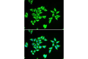 Immunofluorescence analysis of MCF-7 cells using PTRH2 antibody (ABIN5973864). (PTRH2 抗体)