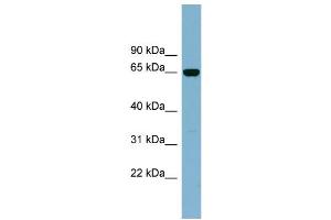 WB Suggested Anti-IL22RA1 Antibody Titration:  0. (IL22 Receptor alpha 1 抗体  (Middle Region))