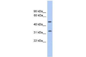 Western Blot showing FAM79B antibody used at a concentration of 1-2 ug/ml to detect its target protein. (TPRG1 抗体  (C-Term))
