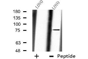 Western blot analysis of extracts from LOVO cells, using CAPN10 antibody. (CAPN10 抗体  (N-Term))