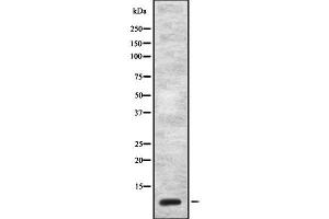Western blot analysis of CCK using NIH-3T3 whole cell lysates (Cholecystokinin 抗体  (Internal Region))