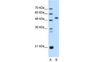 ST14 antibody used at 0. (ST14 抗体)