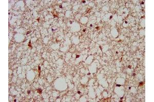 IHC image of ABIN7159209 diluted at 1:200 and staining in paraffin-embedded human brain tissue performed on a Leica BondTM system. (MC3R 抗体  (AA 38-74))