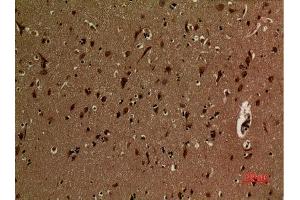 Immunohistochemistry (IHC) analysis of paraffin-embedded Human Brain, antibody was diluted at 1:100.