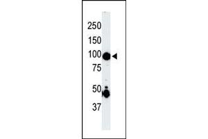 The anti-P4K2 Pab (ABIN391081 and ABIN2841226) is used in Western blot to detect P4K2 in mouse skeletal muscle tissue lysate. (MAP4K2 抗体  (AA 288-319))