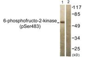 Western blot analysis of extracts from 293 cells treated with Heat shock, using PFKFB2 (Phospho-Ser483) Antibody. (PFKFB2 抗体  (pSer483))