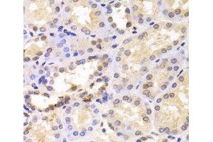 Immunohistochemistry of paraffin-embedded Human kidney using PSMC6 Polyclonal Antibody at dilution of 1:100 (40x lens). (PSMC6 抗体)