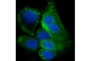 IF analysis of Glycogen synthase 1/GYS1 using anti-Glycogen synthase 1/GYS1 antibody (ABIN7602155). (Glycogen Synthase 1 抗体  (AA 60-640))