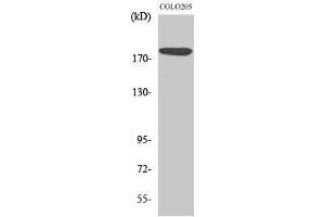 Western Blotting (WB) image for anti-MAP-Kinase Activating Death Domain (MADD) (Internal Region) antibody (ABIN3180153) (MADD 抗体  (Internal Region))