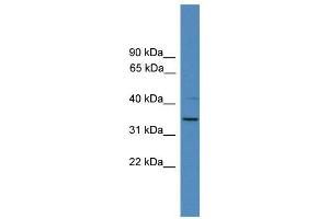 WB Suggested Anti-SNRPA  Antibody Titration: 0. (SNRPA1 抗体  (N-Term))