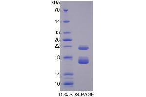 SDS-PAGE analysis of Mouse CBY1 Protein. (CBY1/PGEA1 蛋白)