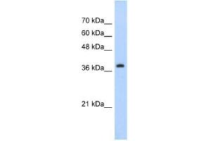 WB Suggested Anti-CBX6 Antibody Titration:  5. (CBX6 抗体  (C-Term))