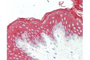 Anti-KRT10 / CK10 / Cytokeratin 10 antibody IHC staining of human skin. (Keratin 10 抗体  (AA 150-179))