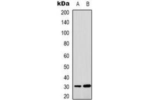 Western blot analysis of MTIF3 expression in HepG2 (A), HUVEC (B) whole cell lysates. (MTIF3 抗体)