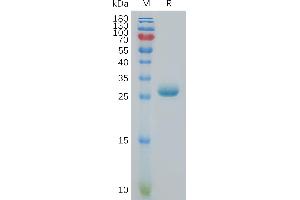 Human A3 Protein, His Tag on SDS-PAGE under reducing condition.