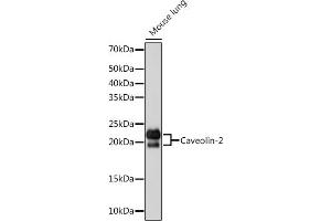 Western blot analysis of extracts of Mouse lung, using Caveolin-2 Rabbit mAb (ABIN7266155) at 1:1000 dilution. (Caveolin 2 抗体)