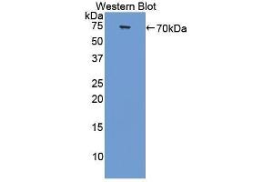 Western Blotting (WB) image for anti-Collagen, Type III, alpha 1 (COL3A1) (AA 1059-1466) antibody (ABIN1858456) (COL3A1 抗体  (AA 1059-1466))