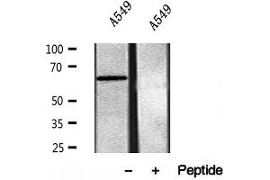 Western blot analysis of extracts of A549 cells, using SQLE antibody. (SQLE 抗体  (C-Term))