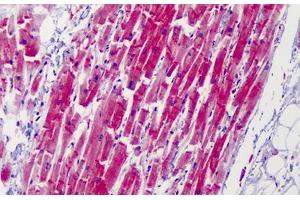 Human Heart: Formalin-Fixed, Paraffin-Embedded (FFPE) (CAPN1 抗体)