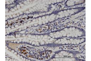 Immunoperoxidase of monoclonal antibody to MGAT5 on formalin-fixed paraffin-embedded human small Intestine. (MGAT5 抗体  (AA 642-739))