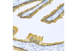 Immunohistochemistry of paraffin-embedded human prostate using BTD antibody (ABIN6127510, ABIN6137680, ABIN6137682 and ABIN6221882) at dilution of 1:100 (40x lens). (BTD 抗体  (AA 284-543))