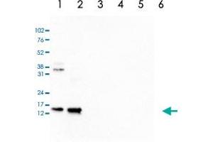 Western Blot analysis of (1) 25 ug whole cell extracts of Hela cells, (2) 15 ug histone extracts of Hela cells, (3) 1 ug of recombinant histone H2A, (4) 1 ug of recombinant histone H2B, (5) 1 ug of recombinant histone H3, (6) 1 ug of recombinant histone H4. (Histone H2B 抗体  (acLys15))