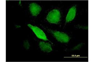 Immunofluorescence of monoclonal antibody to PTX3 on HeLa cell. (PTX3 抗体  (AA 282-380))