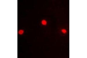 Immunofluorescent analysis of ZFP95 staining in HeLa cells.