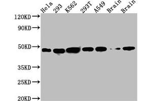 Western Blot Positive WB detected in: Hela whole cell lysate, 293 whole cell lysate, K562 whole cell lysate, 293T whole cell lysate, A549 whole cell lysate, Rat Brain whole cell lysate, Mouse Brain whole cell lysate All lanes: NUDC antibody at 1:1000 Secondary Goat polyclonal to rabbit IgG at 1/50000 dilution Predicted band size: 39 kDa Observed band size: 45 kDa (Recombinant NUDC 抗体)