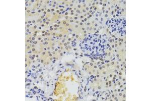 Immunohistochemistry of paraffin-embedded mouse kidney using HNRNPA1 Antibody (ABIN5975570) at dilution of 1/100 (40x lens). (HNRNPA1 抗体)