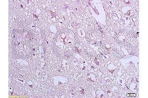 Formalin-fixed and paraffin embedded:  rat brain tissue labeled with Anti-Bax Polyclonal Antibody, unconjugated  (ABIN725390)  at 1: 800 followed by incubation with conjugated secondary antibody and DAB staining (BAX 抗体  (AA 84-175))