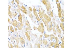 Immunohistochemistry of paraffin-embedded Rat heart using CTGF Polyclonal Antibody at dilution of 1:100 (40x lens).