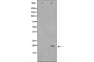 Western blot analysis on Jurkat cell lysate using C1orf57 Antibody (C1orf57 抗体  (C-Term))