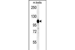 Western Blotting (WB) image for anti-Dapper, Antagonist of beta-Catenin, Homolog 1 (DACT1) (AA 13-41), (N-Term) antibody (ABIN652102)