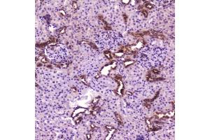 IHC testing of FFPE rat kidney with p65 antibody at 2ug/ml.