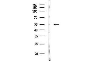 Western blot analysis of lysates from HUVEC cells(heat-shock, 45 min treatment), using KCNJ14 Antibody at 1/1000 dilution. (KCNJ14 抗体  (C-Term))