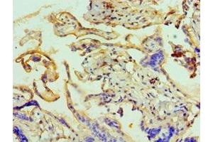 Immunohistochemistry of paraffin-embedded human placenta tissue using ABIN7144073 at dilution of 1:100 (ANAPC5 抗体  (AA 1-250))