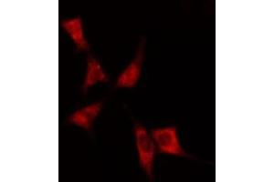 ABIN6275060 staining  Hela cells by IF/ICC. (DHODH 抗体  (Internal Region))