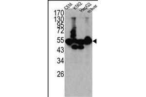 Western blot analysis of CPN1 antibody (N-term) (ABIN391509 and ABIN2841471) in K562, CEM, HEpG2 cell line lysates and mouse liver tissue lysates (35 μg/lane). (CPN1 抗体  (N-Term))