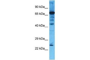 Host: Rabbit  Target Name: CHMP4B  Sample Tissue: Jurkat Whole Cell lysates  Antibody Dilution: 1. (CHMP4B 抗体  (Middle Region))