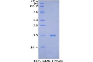 SDS-PAGE analysis of Mouse Bcl2L2 Protein. (BCL2L2 蛋白)