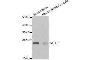 Western blot analysis of extracts of various cell lines, using ATF3 antibody. (ATF3 抗体  (AA 1-181))